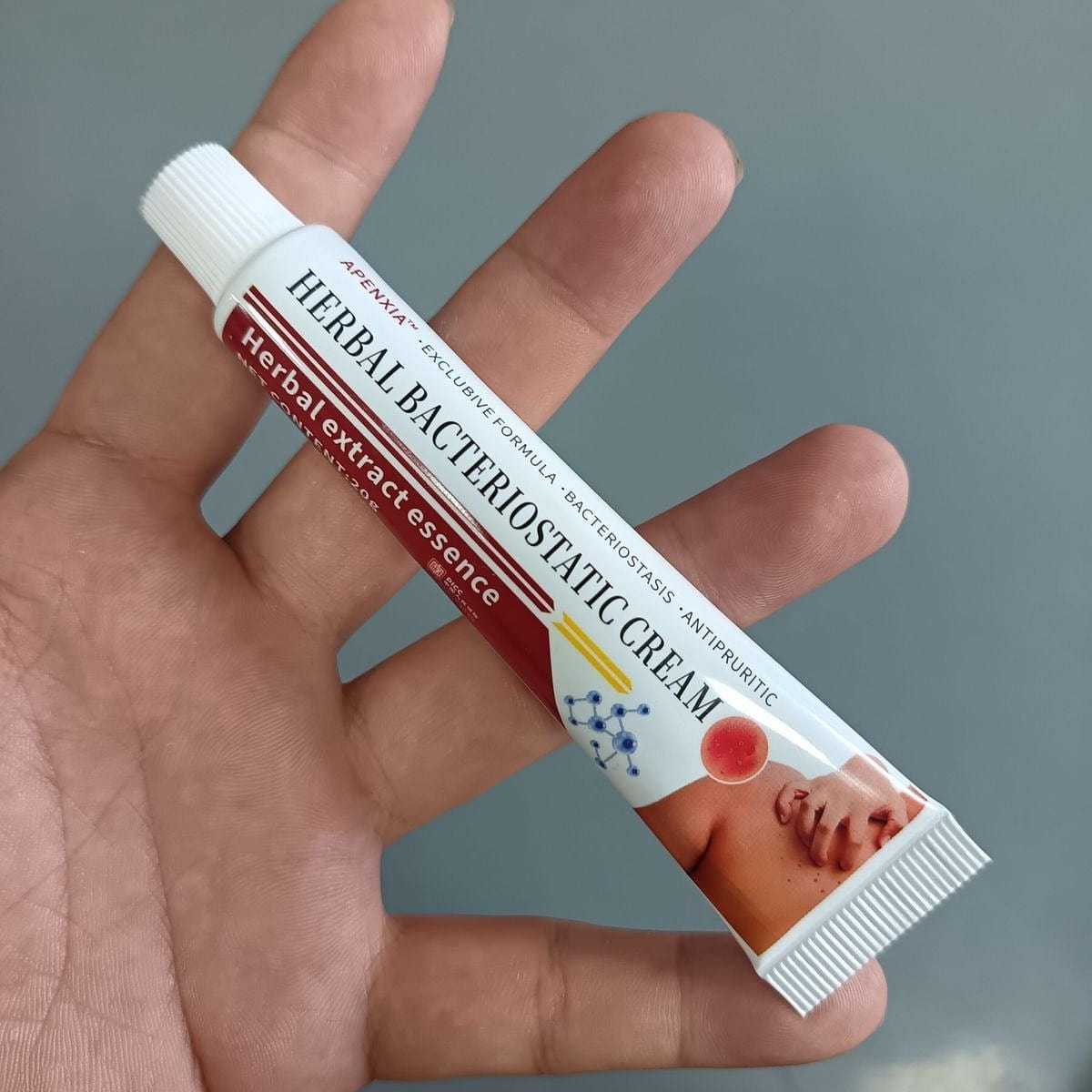 Antipruritic cream itches when heated 20 g