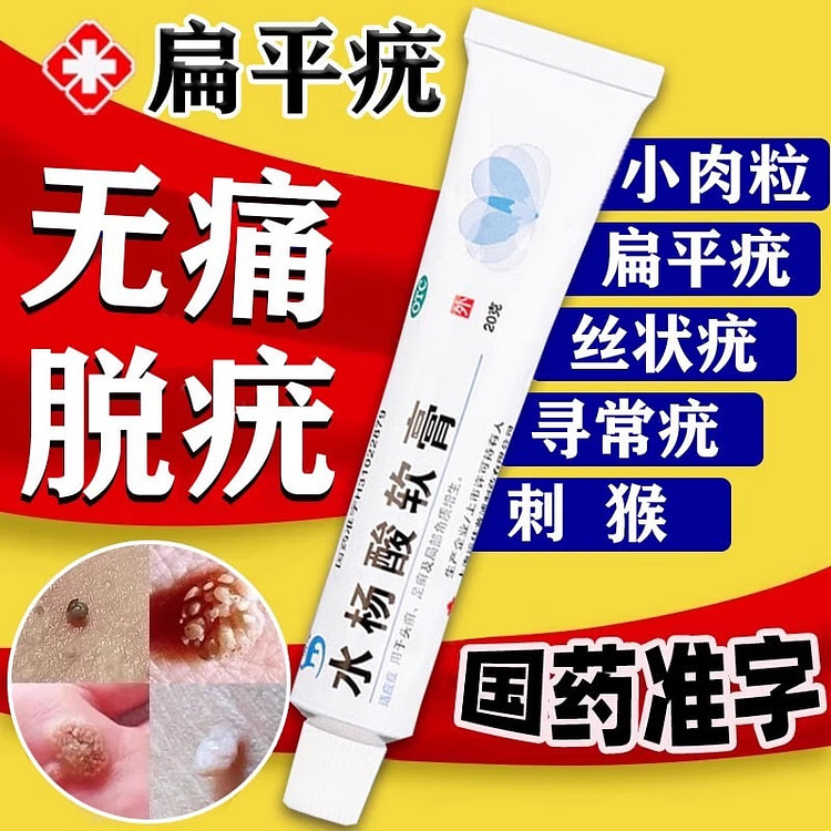 水杨酸软膏 丝状疣疣瘊小肉粒疙瘩20g/支